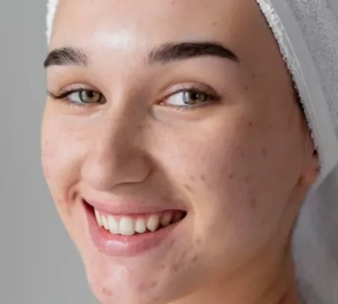 Soin visage découverte ados